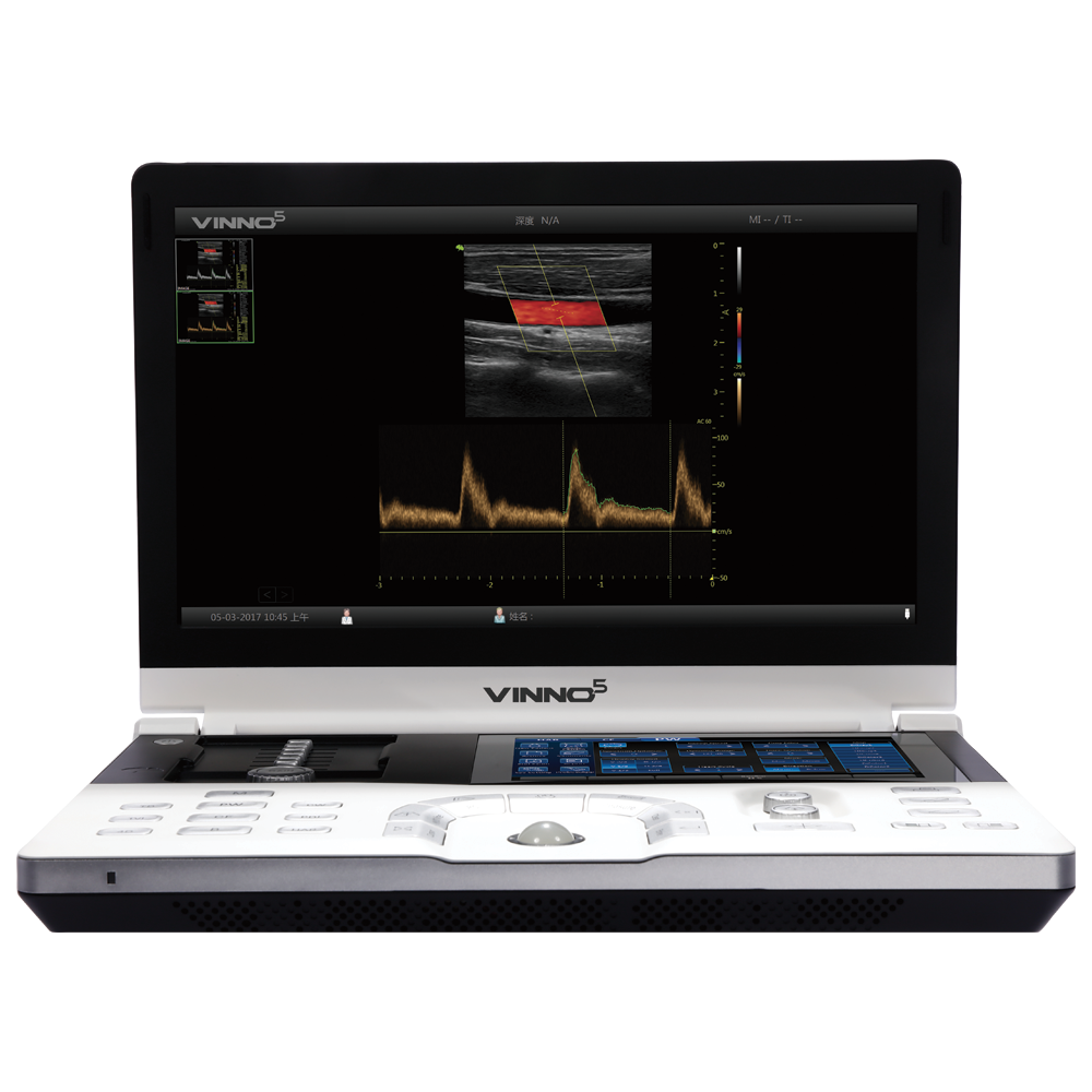 VINNO5 PRO - Mobiles Ultraschallgerät