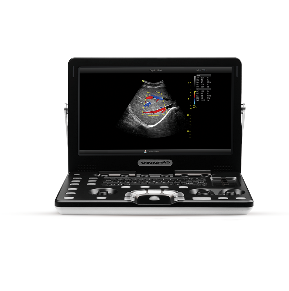 VINNO A5 - Mobiles Ultraschallgerät