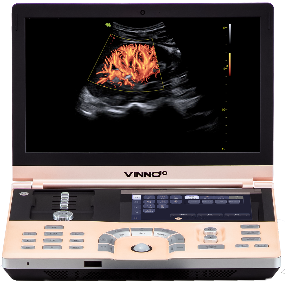 VINNO10 - Mobiles Ultraschallgerät