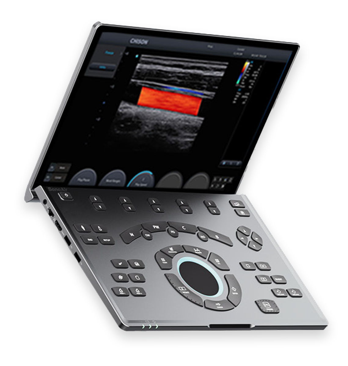 Chison SonoAir 20 - portables Ultraschallgerät